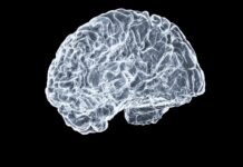 뇌건강, 생활 속 작은 변화가 큰 차이를 만든다 a close up of a human brain on a black background
