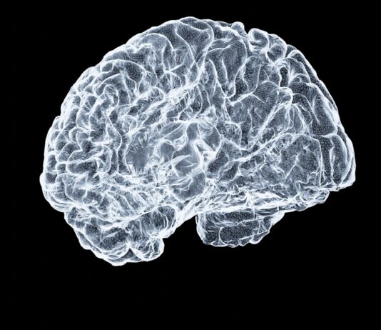 뇌건강, 생활 속 작은 변화가 큰 차이를 만든다 a close up of a human brain on a black background